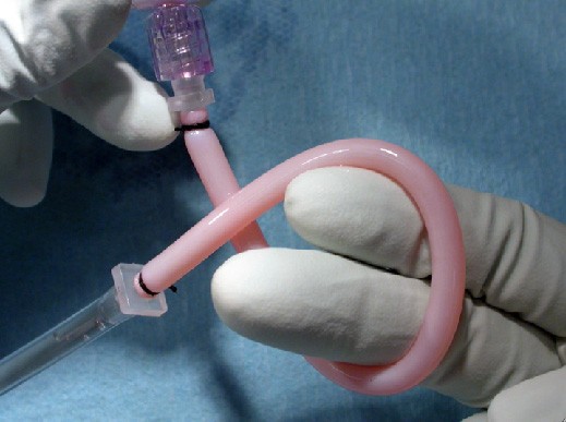 Pacientes británicos probarán una arteria artificial que imita los vasos sanguíneos
